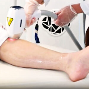 Epilation au laser Medskin sur jambes femme