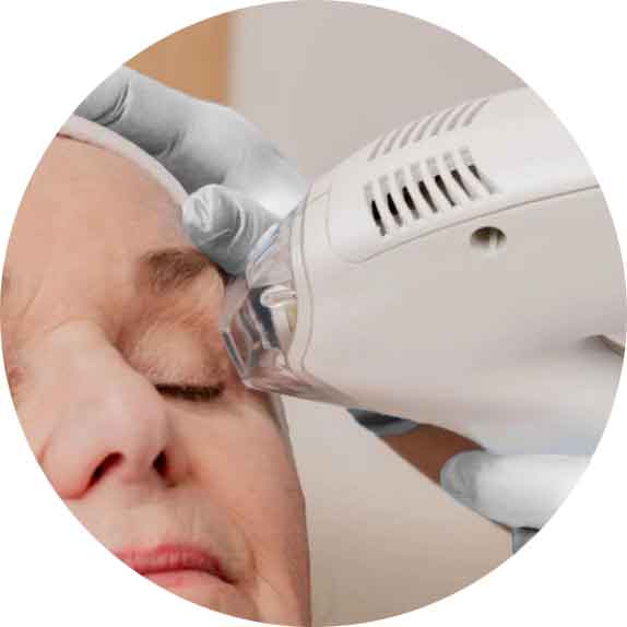Tixmed appareil systeme de rajeunissement thermique fractionné de la peau.