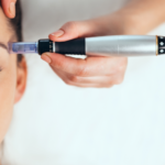 Microneedling premium PM