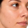 Microneedling premium PM